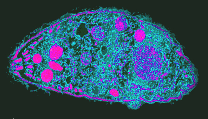 Toxoplasma-gondii